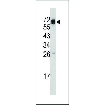 ANTI-CD105 (CENTER E395) antibody produced in rabbit，400UL，SAB1306487-400UL，Sigma
