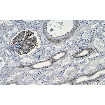 Anti-THSD7A Antibody, clone 2F15-L1 ZooMAb® Rabbit Monoclonal，4X25UL，ZRB1394-4X25UL，Sigma