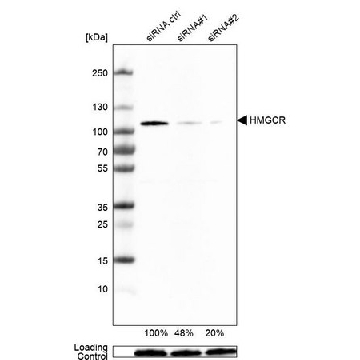Monoclonal Anti-HMGCR antibody produced in mouse，100UL，AMAB90618-100UL，Sigma