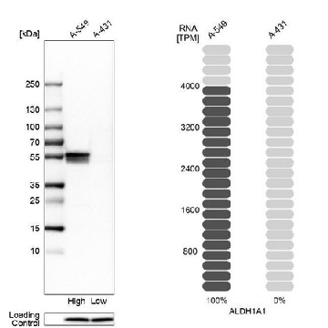 Anti-ALDH1A1 antibody produced in rabbit，100UL，HPA002123-100UL，Sigma