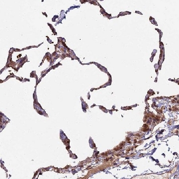 Anti-MEOX1 antibody produced in rabbit，100UL，HPA045214-100UL，Sigma