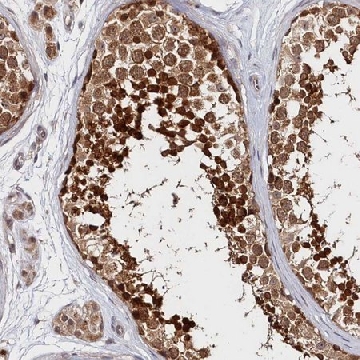 Anti-KATNA1 antibody produced in rabbit，100UL，HPA036207-100UL，Sigma