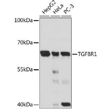 Anti-TGFBR1 antibody produced in rabbit，100UL，SAB5700651-100UL，Sigma