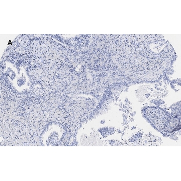 Anti-EpCAM Antibody, clone 1B8 , ZooMAb® Rabbit Monoclonal，4X25UL，ZRB1215-4X25UL，Sigma