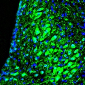 Anti-RAP1GAP antibody produced in rabbit，100UL，HPA001922-100UL，Sigma
