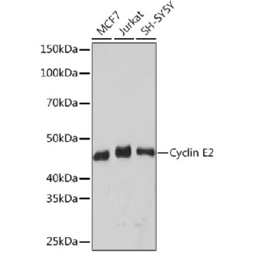 Anti-Cyclin E2 Antibody, clone 0Y7G5, Rabbit Monoclonal，100UL，SAB5702748-100UL，Sigma