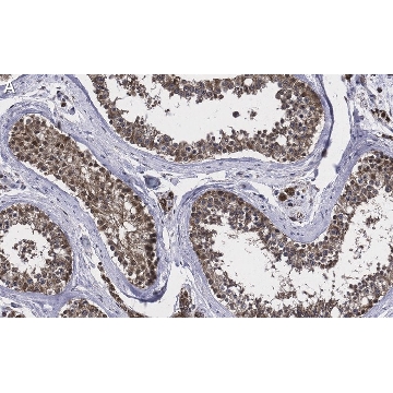 Anti-TSTA3 Antibody, clone 2N10-H1 ZooMAb® Rabbit Monoclonal，25UL，ZRB1198-25UL，Sigma