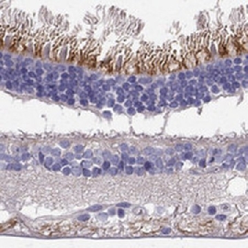Anti-LRIT2 antibody produced in rabbit，100UL，HPA037788-100UL，Sigma