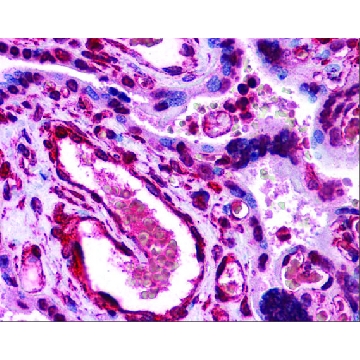 Anti-LIPG antibody produced in rabbit，100UL，SAB2101350-100UL，Sigma