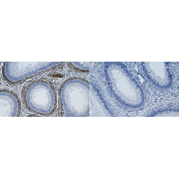 Anti-LTBP4 Antibody, clone 2M8 ZooMAb® Rabbit Monoclonal，254G，ZRB2489-25UL，Sigma