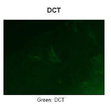 Anti-DCT antibody produced in rabbit，100UL，SAB2106702-100UL，Sigma