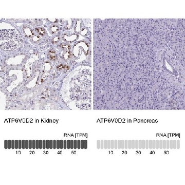 Anti-ATP6V0D2 antibody produced in rabbit，100UL，HPA055327-100UL，Sigma