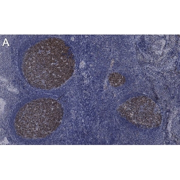 Anti-BCL-6 Antibody, clone 1B7 ZooMAb® Rabbit Monoclonal，25UL，ZRB1782-25UL，Sigma