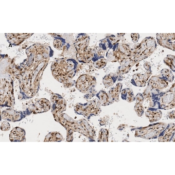 Anti-YAP1 Antibody, clone 4F22, ZooMAb® Rabbit Monoclonal，4X25UL，ZRB1001-4X25UL，Sigma