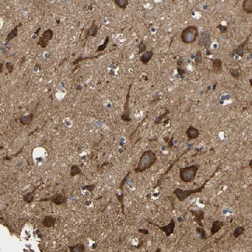 Anti-LRRCC1 antibody produced in rabbit，100UL，HPA012893-100UL，Sigma