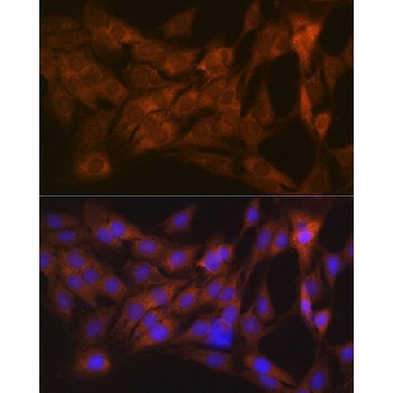 Anti-CLEC3B/Tetranectin antibody produced in rabbit，100UL，SAB5701527-100UL，Sigma