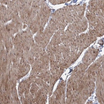 Anti-ZSCAN23 antibody produced in rabbit，100UL，HPA035960-100UL，Sigma