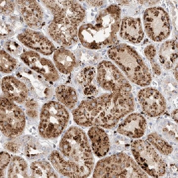 Anti-GGH antibody produced in rabbit，100UL，HPA025226-100UL，Sigma
