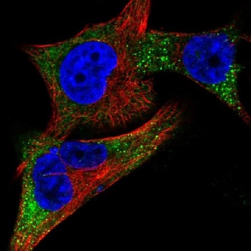 Anti-TYR antibody produced in rabbit，100UL，HPA043241-100UL，Sigma