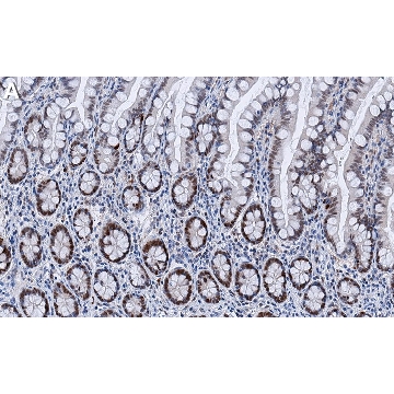 Anti-Vitamin D3 Receptor Antibody, clone 1M19 ZooMAb® Rabbit Monoclonal，25UL，ZRB1877-25UL，Sigma