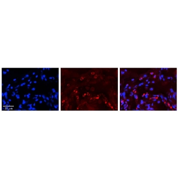 Anti-GAA antibody produced in rabbit，100UL，SAB2100872-100UL，Sigma