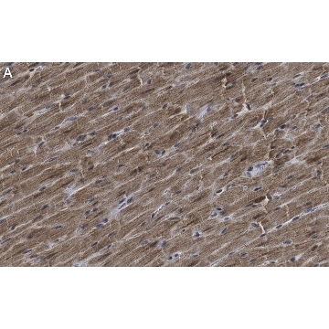 Anti-G0S2 Antibody, clone 2C13 ZooMAb® Rabbit Monoclonal，25UL，ZRB1813-25UL，Sigma
