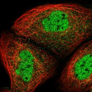 Anti-UHRF2 antibody produced in rabbit，100UL，HPA026633-100UL，Sigma