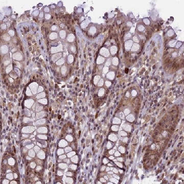 Anti-RBBP8 antibody produced in rabbit，100UL，HPA039890-100UL，Sigma