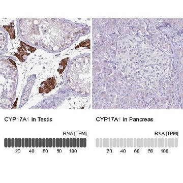 Anti-CYP17A1 antibody produced in rabbit，100UL，HPA048533-100UL，Sigma