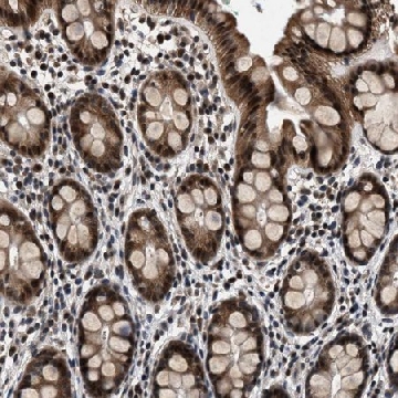 Anti-RBM33 antibody produced in rabbit，100UL，HPA021768-100UL，Sigma
