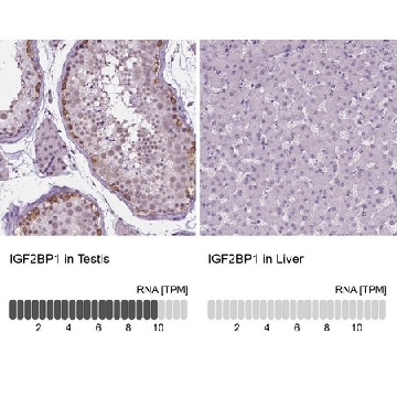 Anti-IGF2BP1 antibody produced in rabbit，100UL，HPA021367-100UL，Sigma