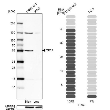 Anti-p53 antibody produced in rabbit，100UL，HPA051244-100UL，Sigma