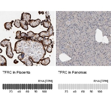 抗-TFRC 兔抗，100UL，HPA028598-100UL，Sigma