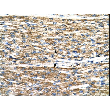 Anti-PNPLA3 antibody produced in rabbit，100UL，SAB2108057-100UL，Sigma