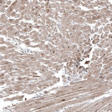 Anti-COL12A1 antibody produced in rabbit，100UL，HPA009143-100UL，Sigma