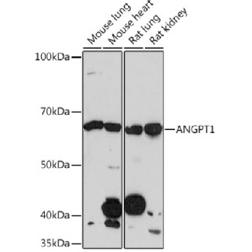 Anti-ANGPT1 Antibody, clone 6C4S7, Rabbit Monoclonal，100UL，SAB5702357-100UL，Sigma