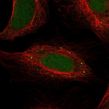 Anti-Fam186A Antibody Produced In Rabbit，1004G，HPA064735-100UL，Sigma