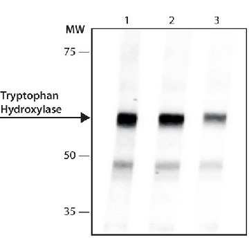 Anti-Tryptophan Hydroxylase antibody, Mouse monoclonal，100UL，SAB4200723-100UL，Sigma
