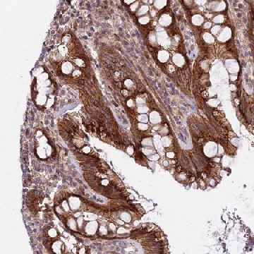 Anti-ITGB6 antibody produced in rabbit，100UL，HPA023626-100UL，Sigma