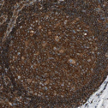 Anti-ARPC2 antibody produced in rabbit，100UL，HPA008352-100UL，Sigma