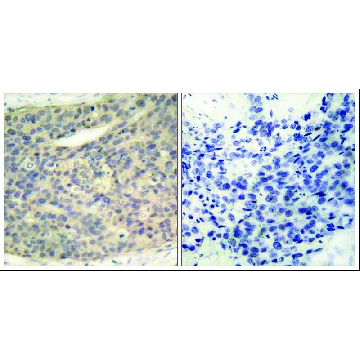 Anti-phospho-LIMK1 (pThr⁵⁰⁸) antibody produced in rabbit，100UG，SAB4300103-100UG，Sigma
