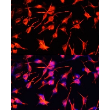 Anti-GFAP antibody produced in rabbit，100UL，SAB5700611-100UL，Sigma