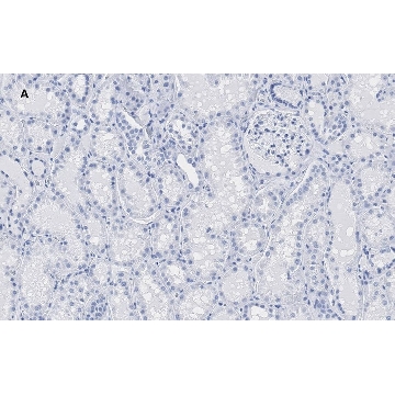 Anti-HMGB1 Antibody, clone 3K6, ZooMAb® Rabbit Monoclonal，25UL，ZRB1002-25UL，Sigma