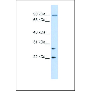 抗-JOSD2，（N-端） 兔抗，100UL，SAB2103354-100UL，Sigma