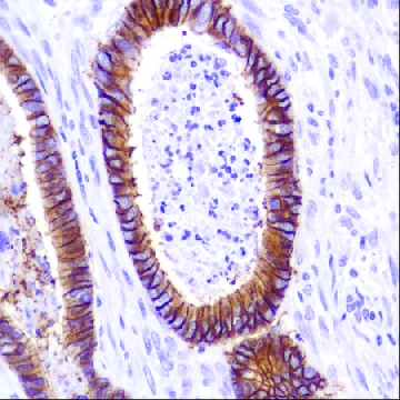 Anti-Cadherin -17 antibody, Rabbit monoclonal，100UL，SAB5500021-100UL，Sigma
