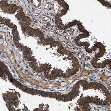 Anti-FZD6 antibody produced in rabbit，100UL，HPA017991-100UL，Sigma