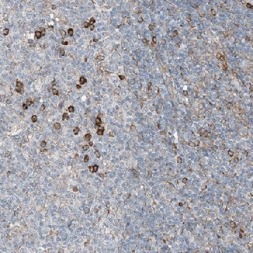 Anti-CERKL antibody produced in rabbit，100UL，HPA035444-100UL，Sigma