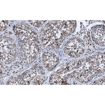 Anti-G3BP1 Antibody, clone 1B10 ZooMAb® Rabbit Monoclonal，25UL，ZRB1789-25UL，Sigma