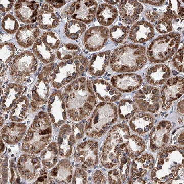 Anti-SMPDL3A antibody produced in rabbit，100UL，HPA030148-100UL，Sigma