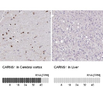 Anti-CARNS1 antibody produced in rabbit，100UL，HPA038569-100UL，Sigma